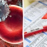 Preboj v iskanju zdravila za HIV: znanstvenikom je uspelo prej